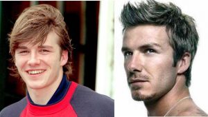 Chirurgie esthétique: David Beckham avant et après